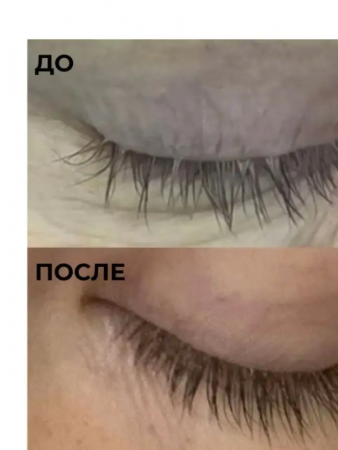 Сыворотка для роста ресниц CLASSIC с Capixyl/Капиксил 3%, 3 мл / Careprost